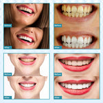 Load image into Gallery viewer, Teeth whitening kit For dropshopping seller Contact us before you place an order|Teeth Whitening|
