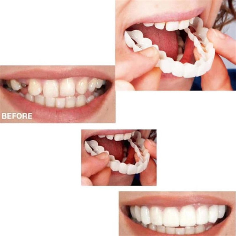 Oral Hygiene For Bad Teeth Smile Veneer No-toxic Practical Plastic Smile Fake Tooth Cover Orthodontic Braces - Denture Care Products