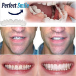 Load image into Gallery viewer, Oral Hygiene For Bad Teeth Smile Veneer No-toxic Practical Plastic Smile Fake Tooth Cover Orthodontic Braces - Denture Care Products
